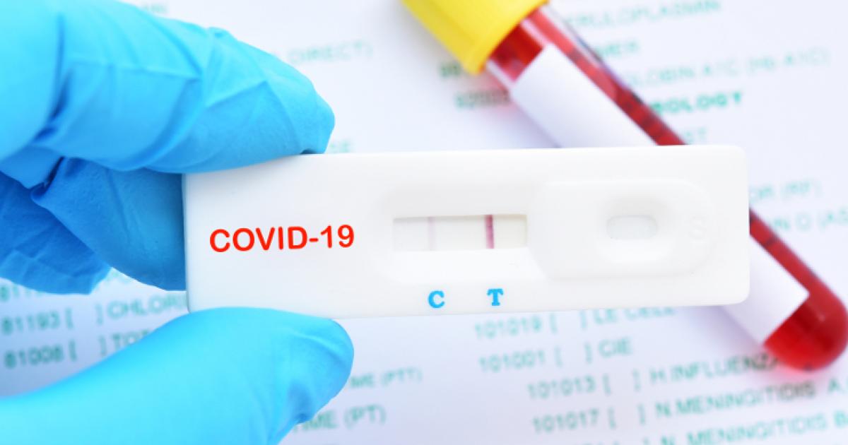 Covid-19 : votre employeur peut vous proposer un test antigénique